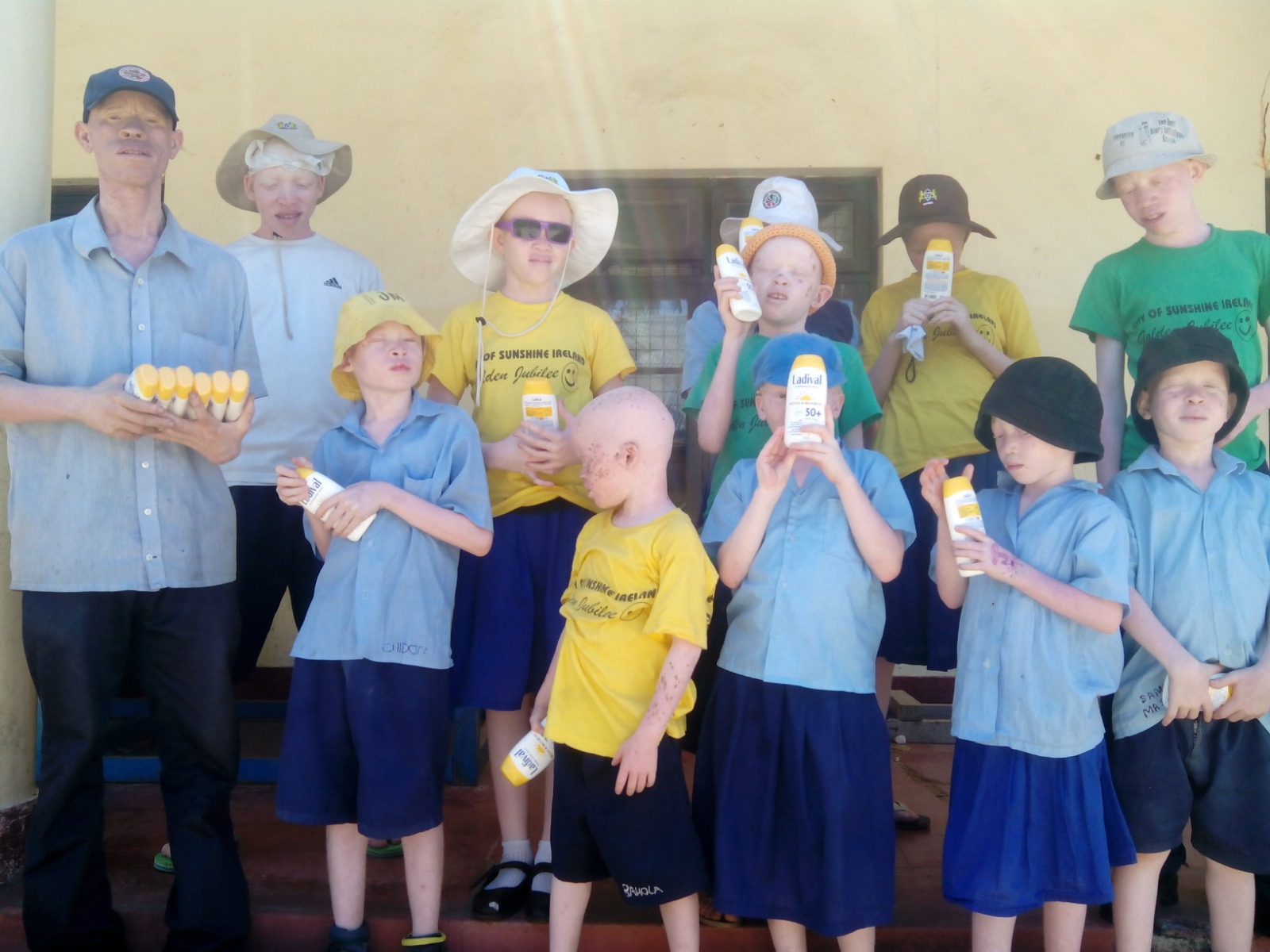 Community of people with Albinism